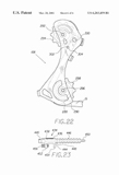 US Patent 6,203,459 - Vivo V2 scan 8 thumbnail