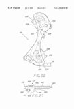 US Patent 6,416,434 - Vivo V2 scan 8 thumbnail