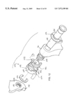 US Patent 7,572,199 - Vivo scan 22 thumbnail